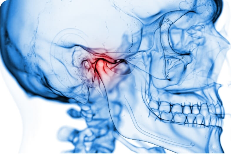顎関節症の原因と噛み合わせから起こる不調