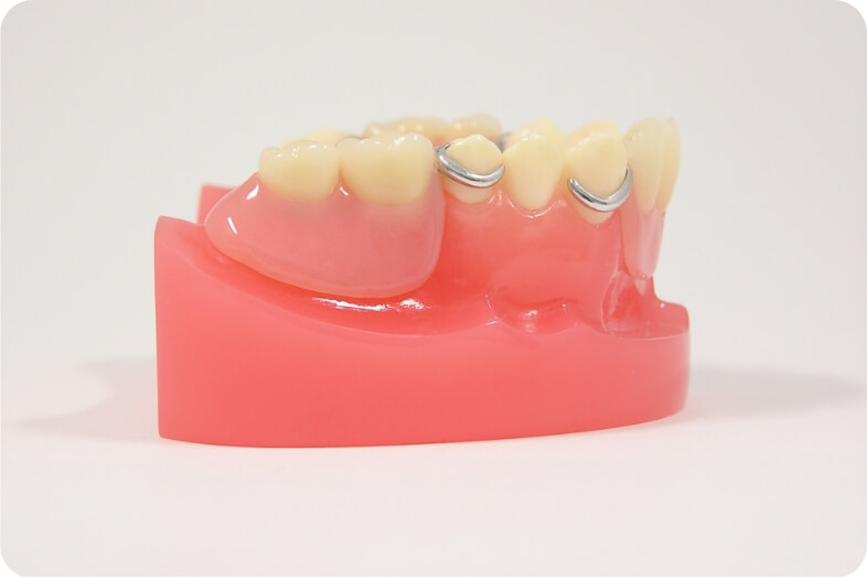 保険適用の入れ歯はプラスチック製