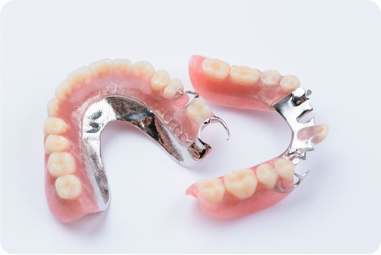より軽く違和感の少ないチタン床義歯