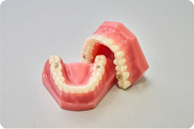 難しい歯並びにも対応可能